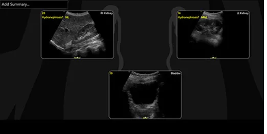 renal-diagram-review-desktop-updated