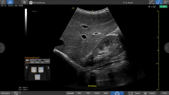 Renal-Diagram_560x560