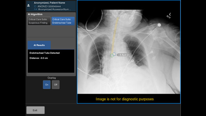 Artificial Intelligence and X-Ray