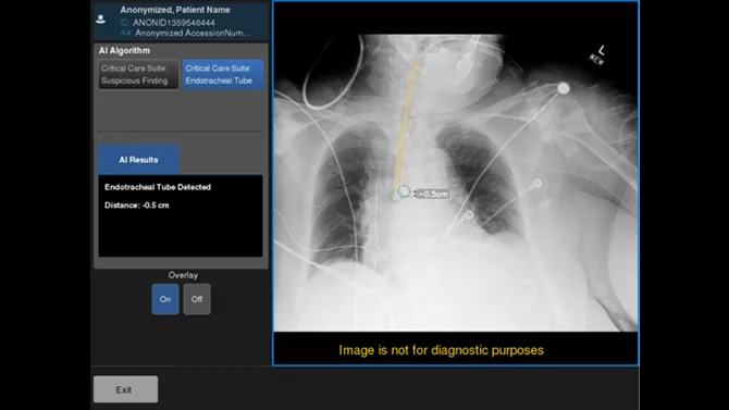 Artificial Intelligence and X-Ray