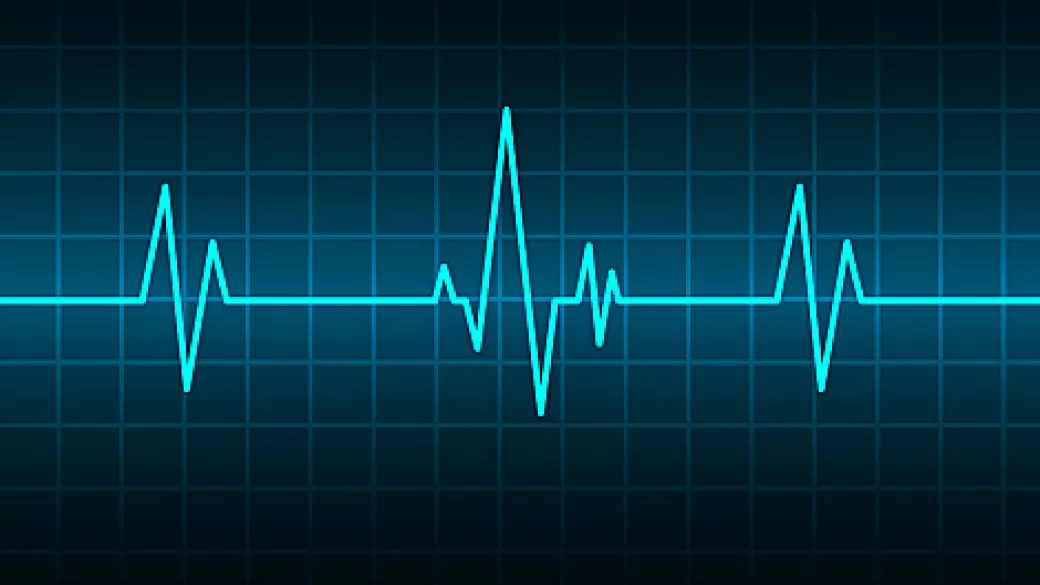retrospective-ecg-insights-desktop