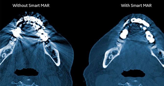 Revolution Aspire Feature cards half width overlay 2