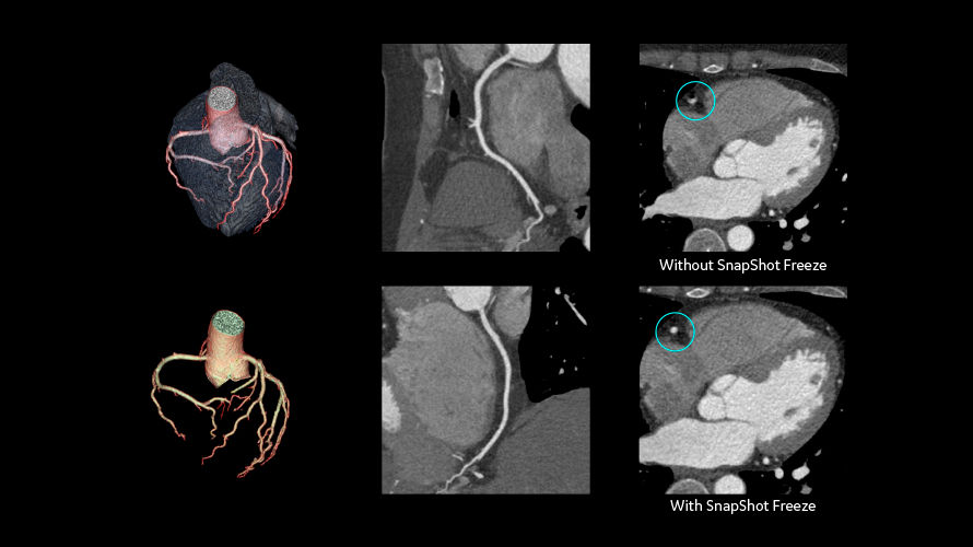 revolution cardiac1