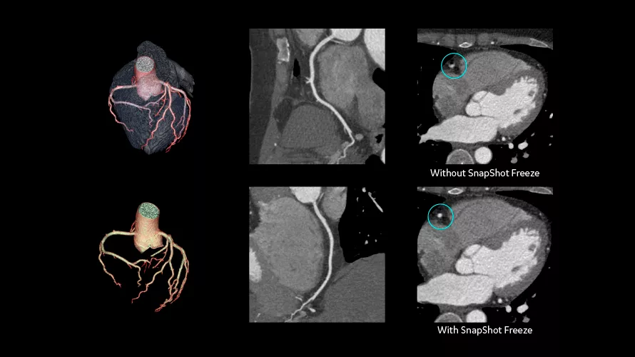 revolution cardiac1