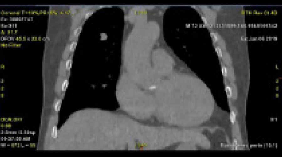 Revolution-CT-ES-4D-CT-clinical-image-A-Full-Size