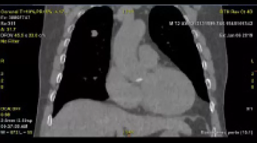 Revolution-CT-ES-4D-CT-clinical-image-A-Full-Size