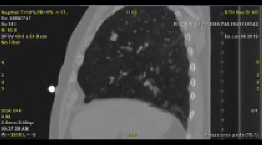 Revolution-CT-ES-4D-CT-clinical-image-B-Full-Size