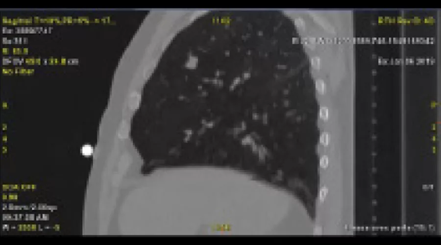 Revolution-CT-ES-4D-CT-clinical-image-B-Full-Size