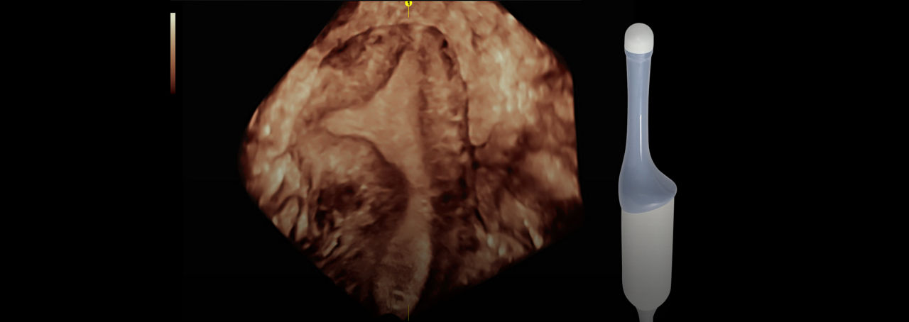 ric5-9-rs-probe-ci-en