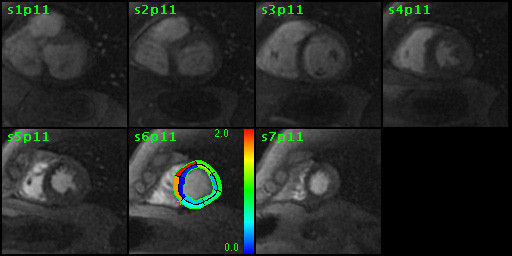 ries-do-not-clone-advanced-visualization-applications-cardiacvx-aw-cardiac-vs_overview.jpg