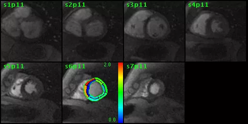 ries-do-not-clone-advanced-visualization-applications-cardiacvx-aw-cardiac-vs_overview.jpg