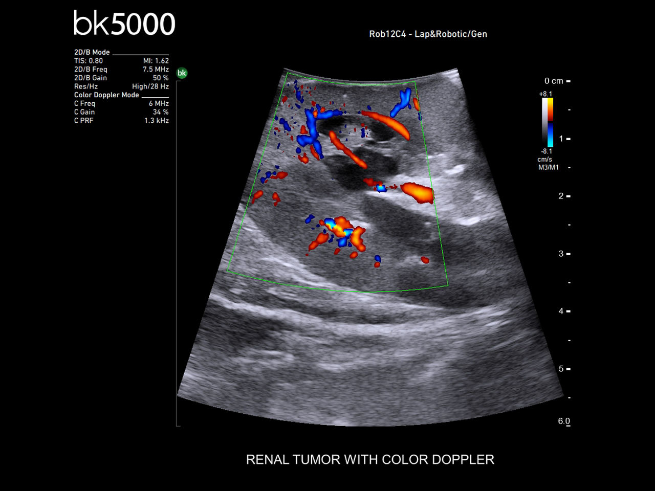 robotics-assisted-surgery-desktop