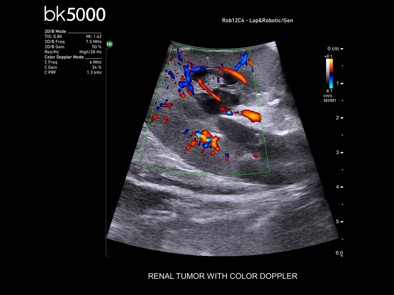 robotics-assisted-surgery-desktop