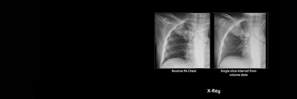 roduct-categories-radiography-advanced-applications-advanced-applications-xray