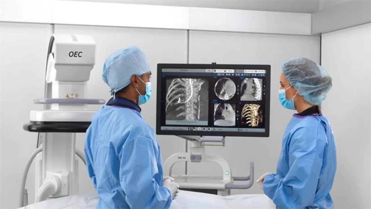 OEC 3D Lung Image