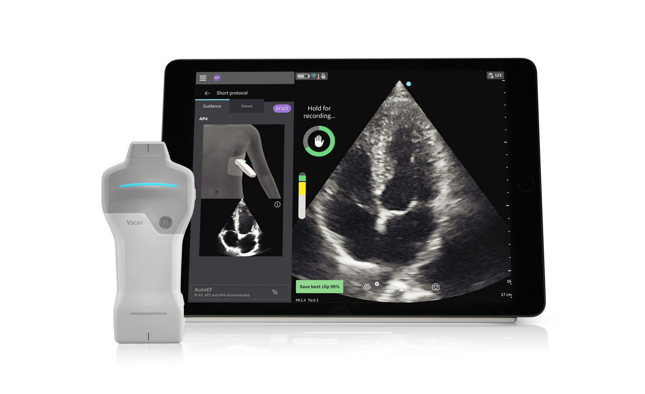 Vscan Air SL