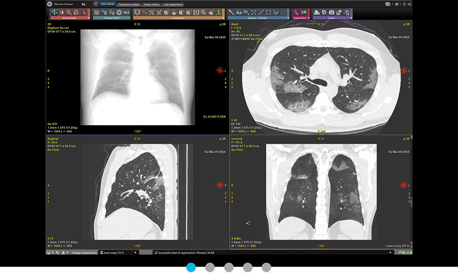 S-Curve-470px-Thoracic-VCAR
