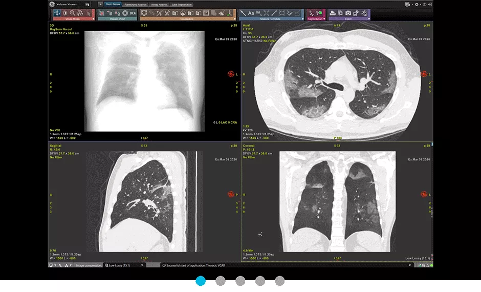 S-Curve-470px-Thoracic-VCAR