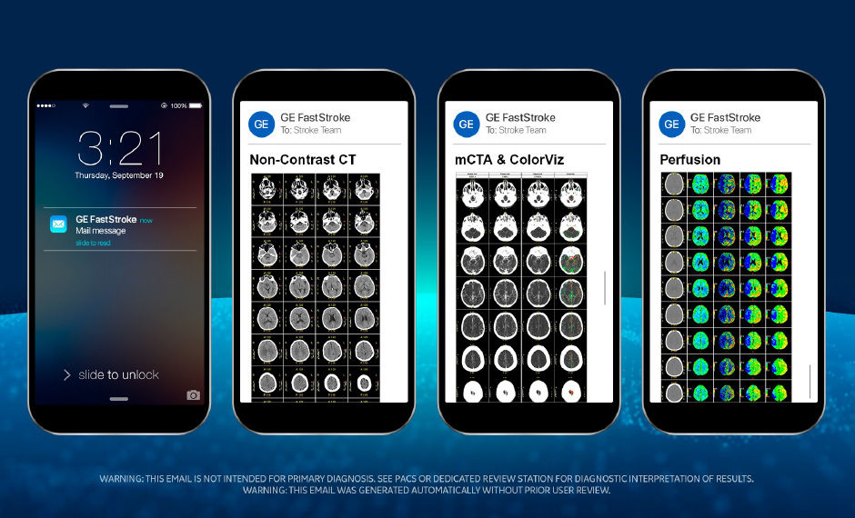 S-Curve-FastStroke-with-StrokeSens-08