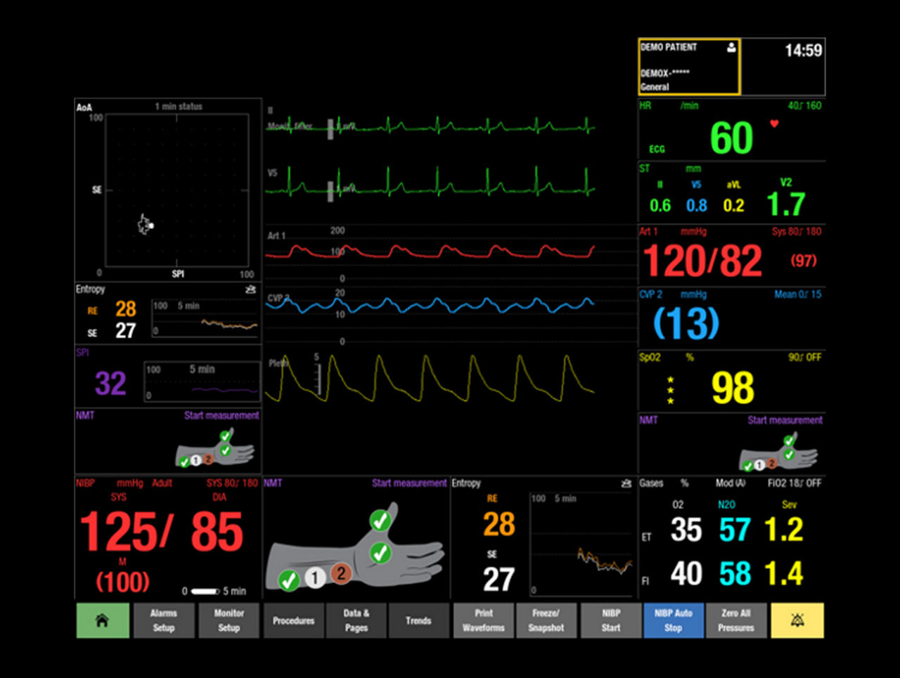 s-curve-NMT-hookup-advisor-desktop