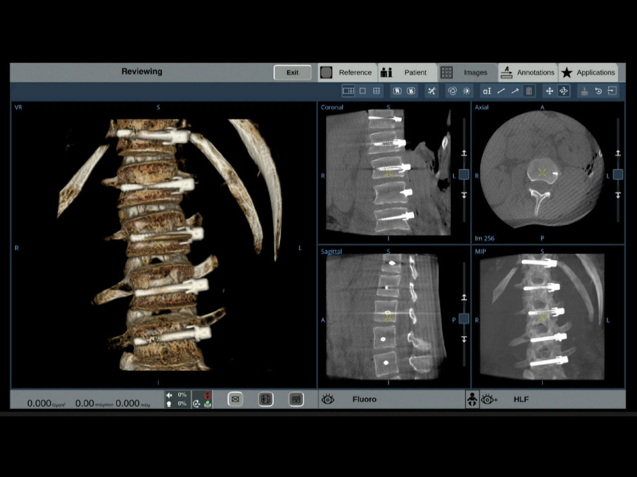 s-curve-precise-desktop