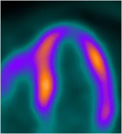 S-curve-scanner
