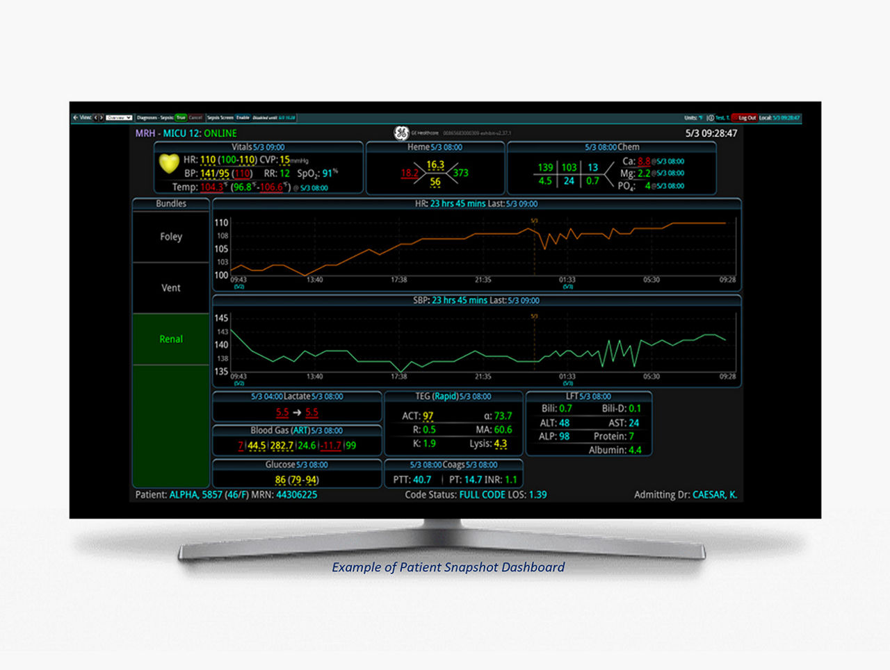 s-curve-view-one-patient-desktop-v3
