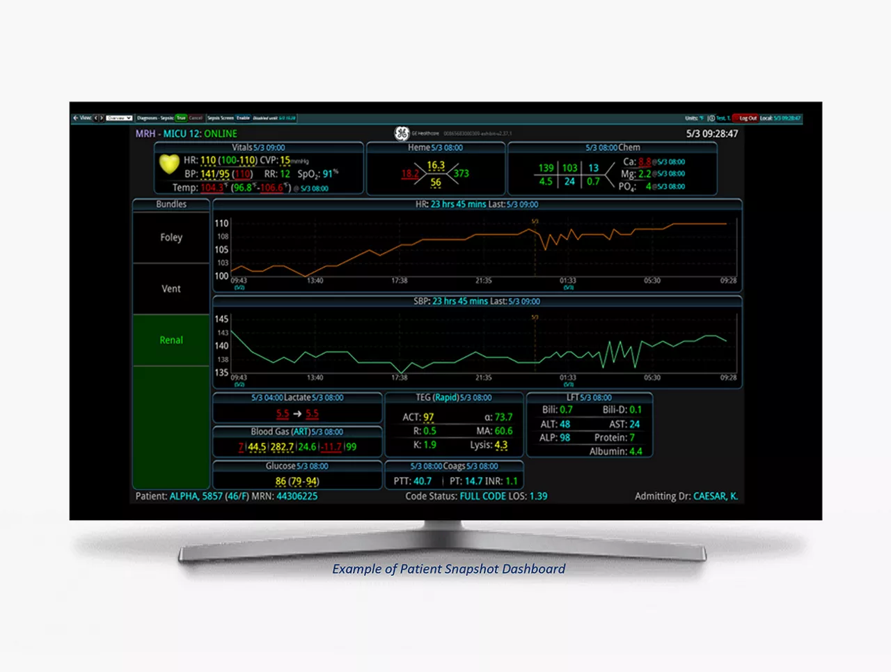 s-curve-view-one-patient-desktop-v3