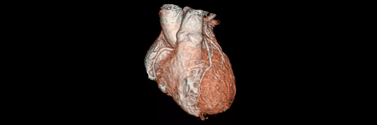 s-magnetic-resonance-imaging-pediatric-imaging-3d-heart-3d_heart_application_spotlight.jpg