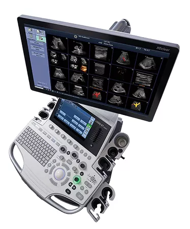 LOGIQ S7