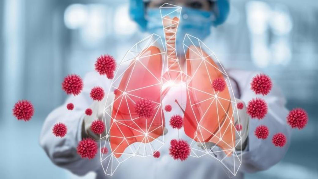 In the background, a healthcare worker is shown reaching her arms out in front of her. She is wearing full PPE, including a surgical mask, a white coat, gloves, and a disposable surgical bouffant caps. In front of her out stretched arms is a pictogram of a pair of lungs, trachea, and large particles.