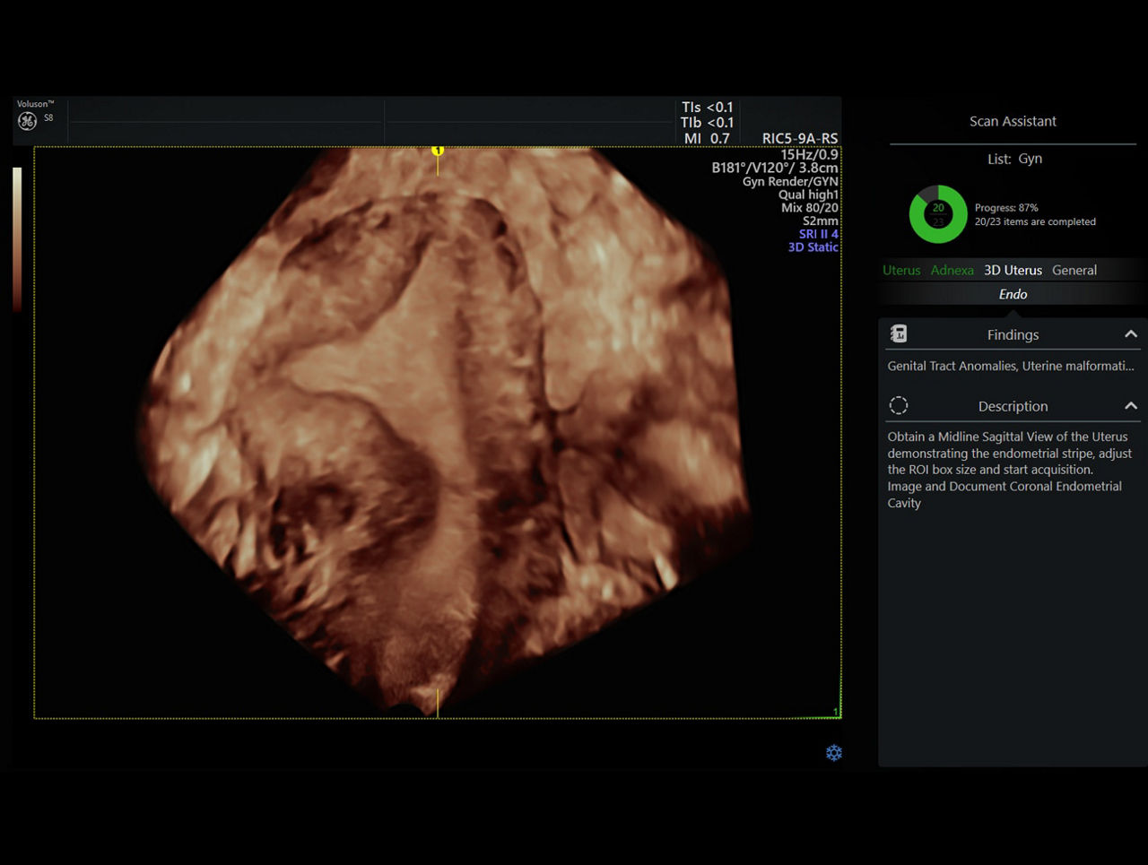 scan-assistant-ci-en
