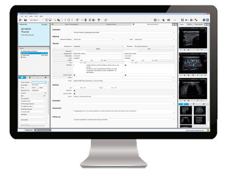 screenshot thyroid_new