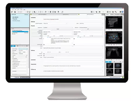 screenshot thyroid_new