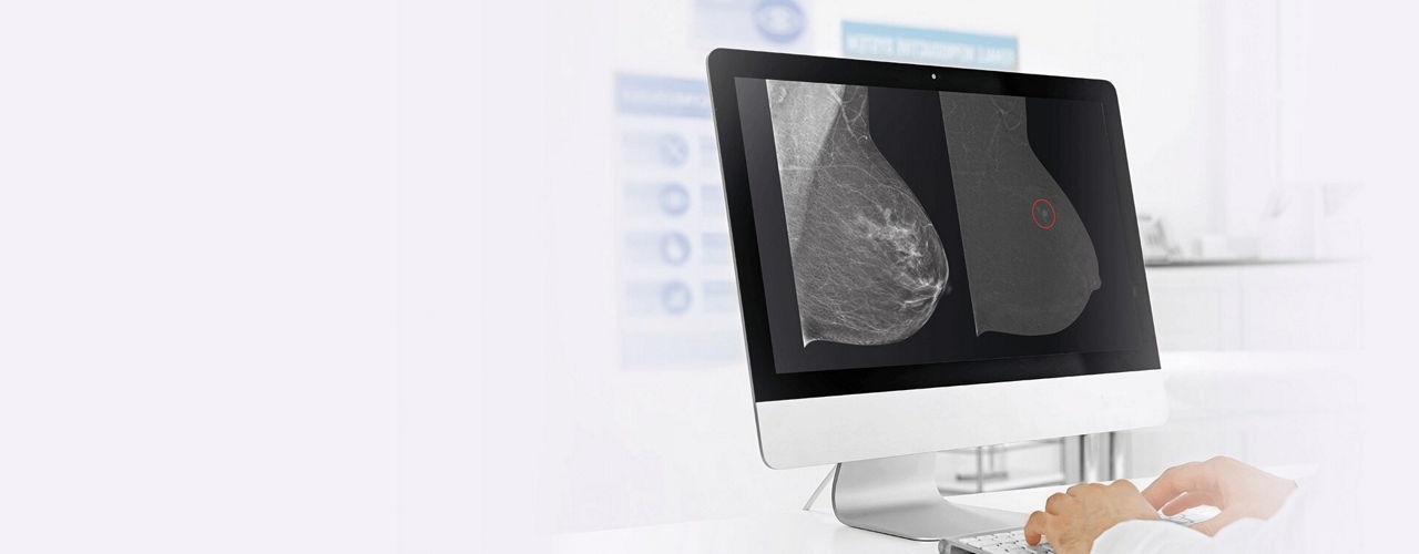 seno-bright-banner-ba-en