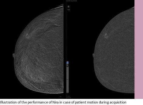 SenoBright HD?-Nira image quality improvements