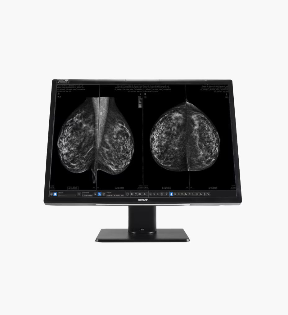 seno-iris-feature2-ci-en