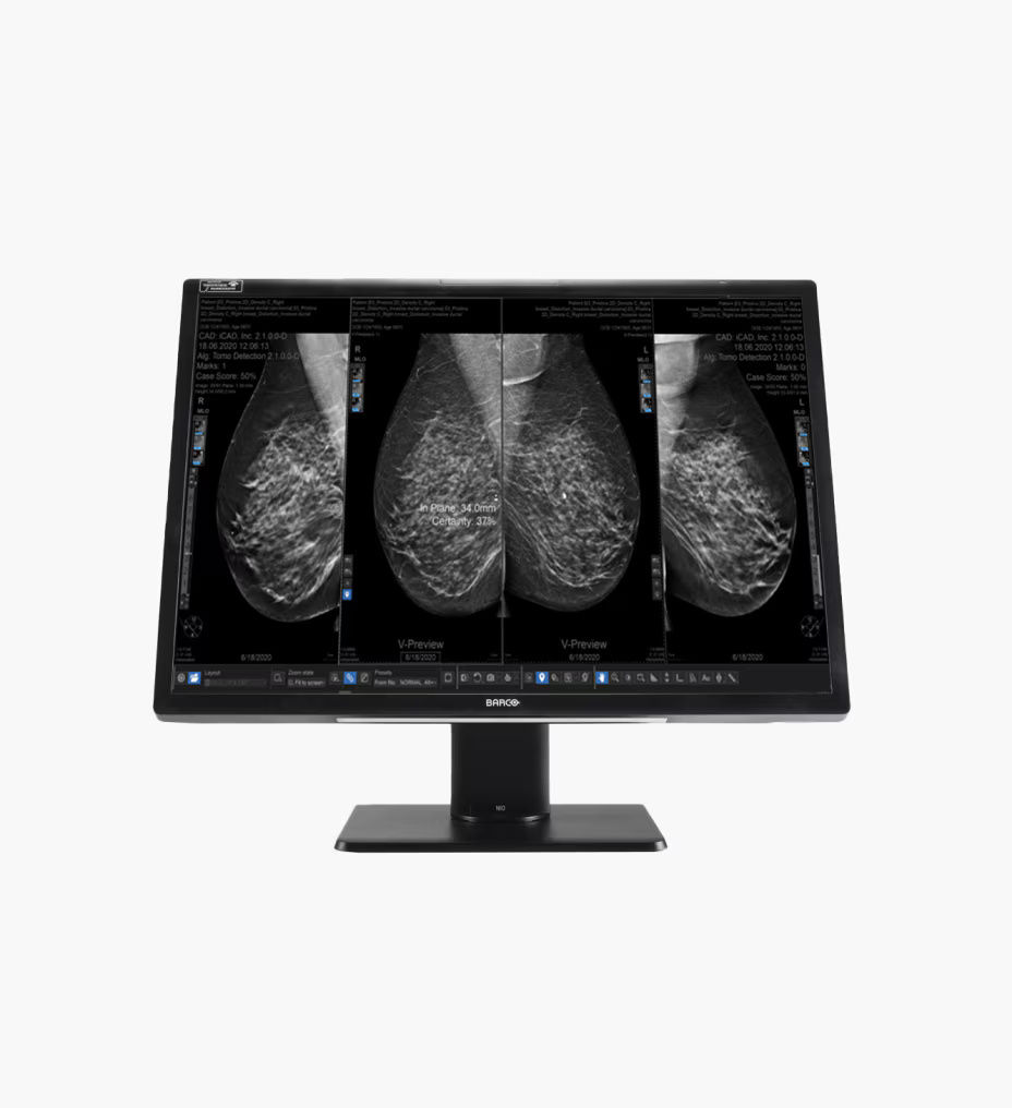 seno-iris-feature3-ci-en