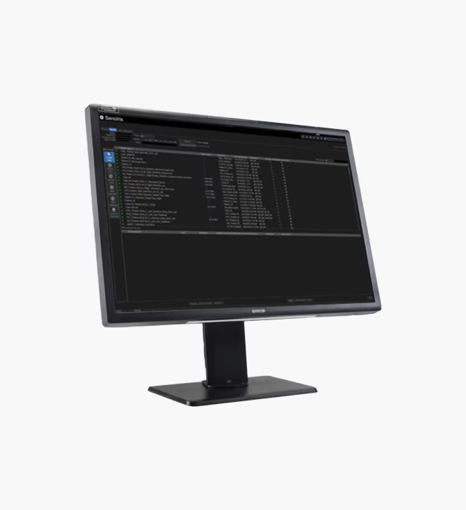 seno-iris-feature4-ci-en