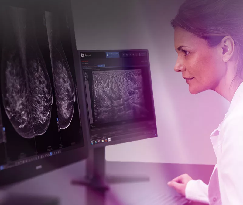 seno-iris-ge-mammography-application-banner-carre