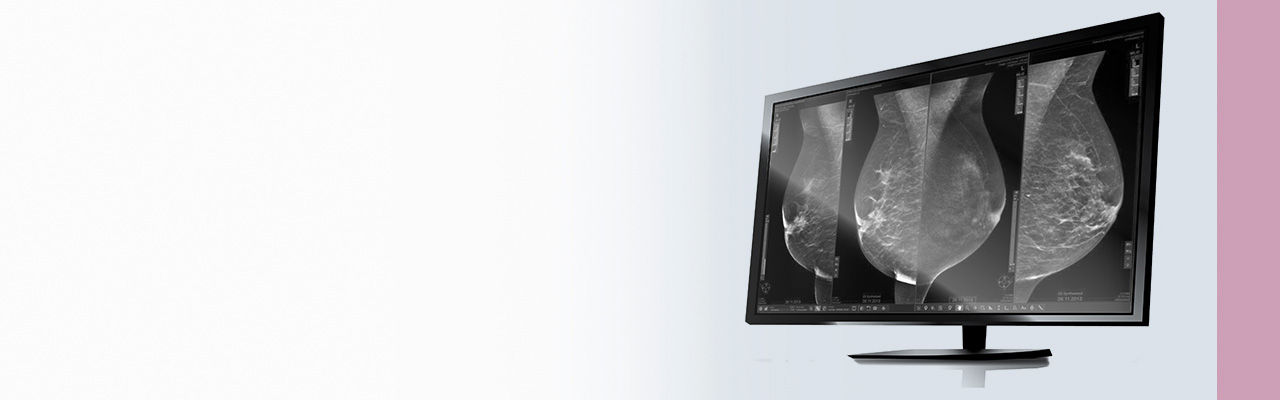 Seno-Iris-Hero-1280x400