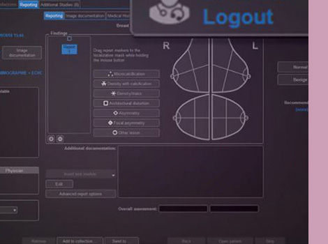 Seno-Iris-Scurve-1-comprehensive-and-customizable-interface-470x350