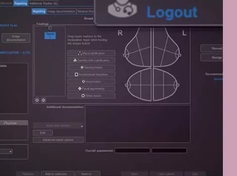 Seno-Iris-Scurve-1-comprehensive-and-customizable-interface-470x350