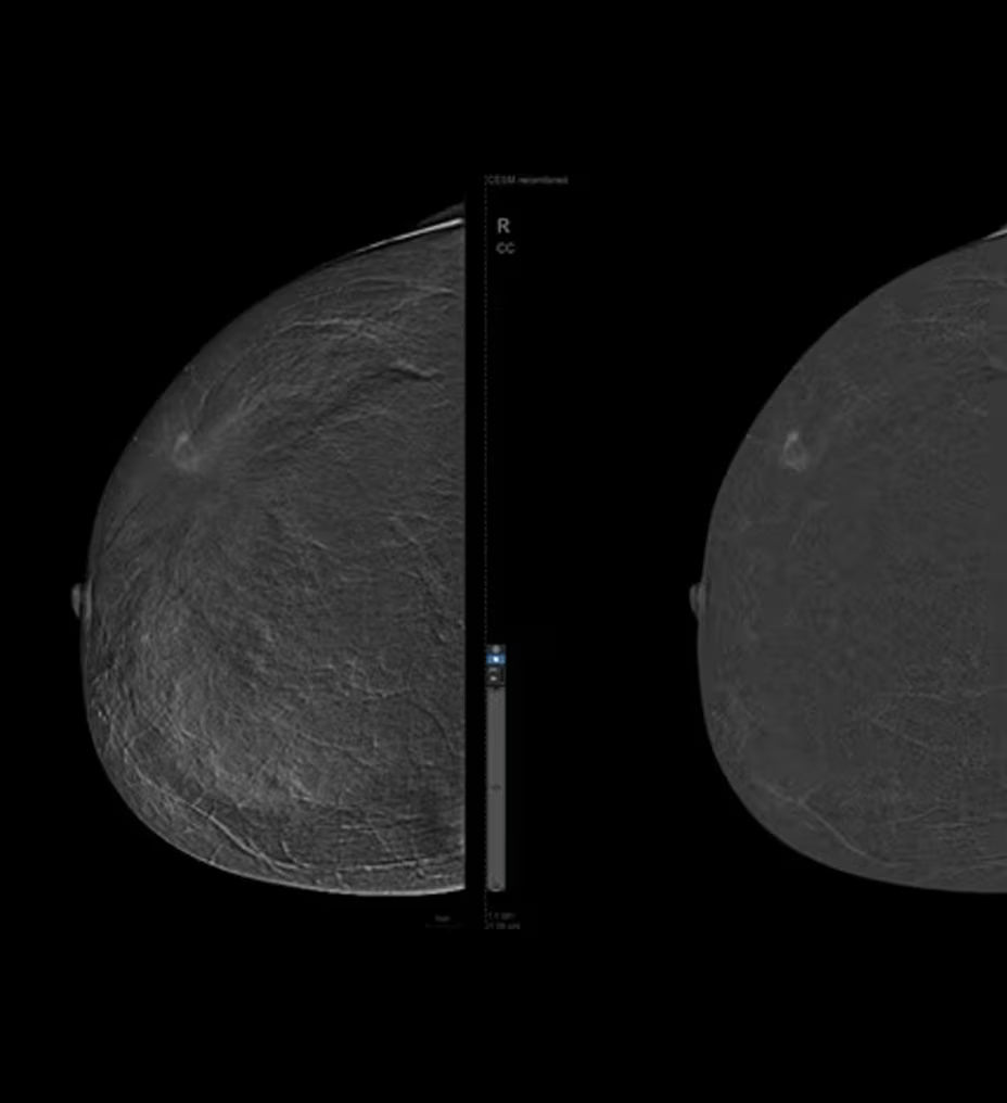 senobright-highlight4-ci-en