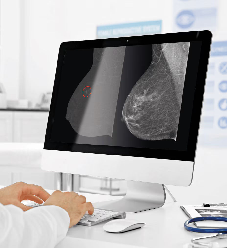 senobright-highlight5-ci-en