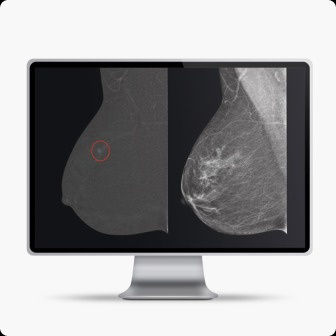 senobright-tile-image-ci-en