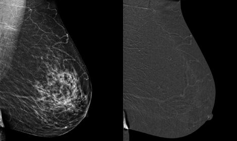 sense breast