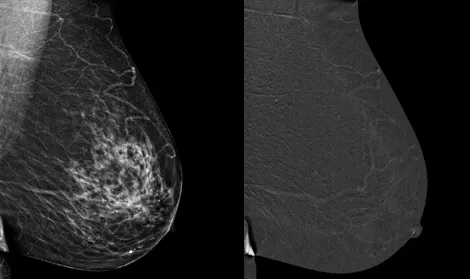 sense breast
