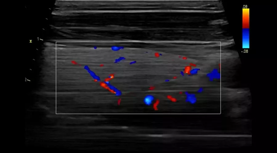 Cardiac Auto Doppler