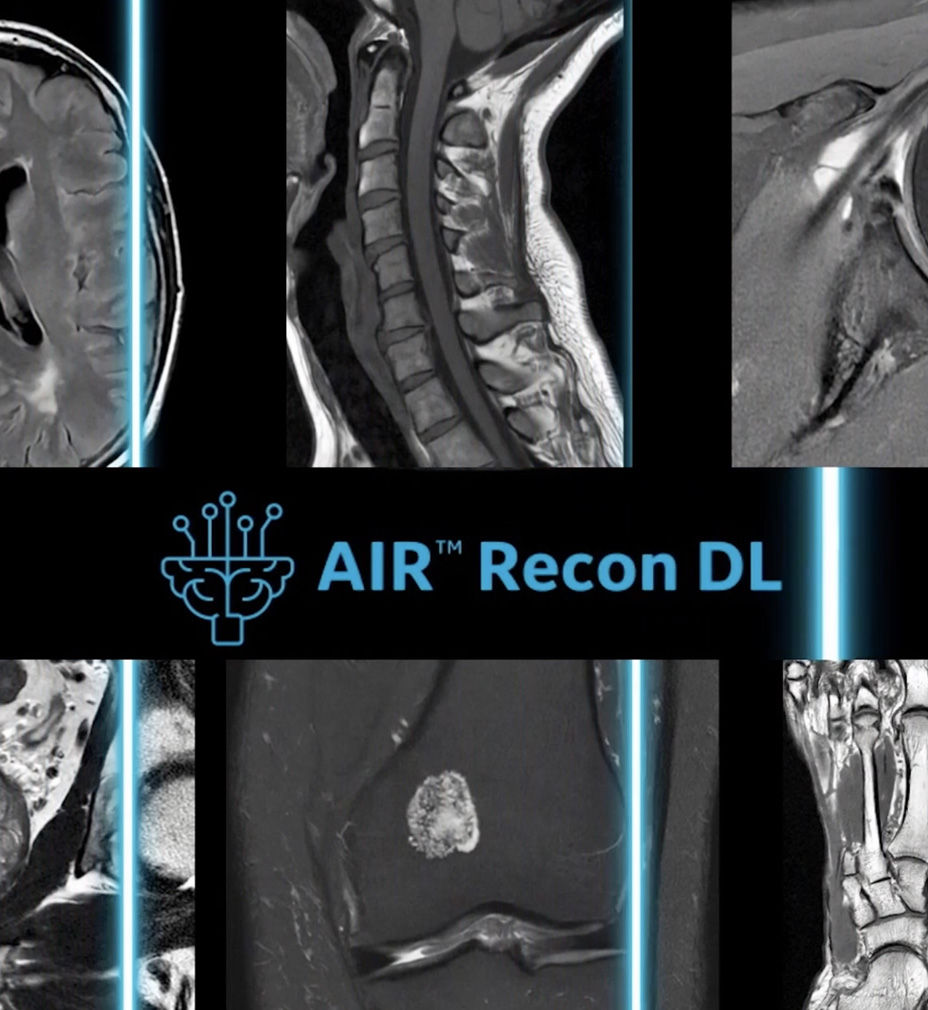 Sharper scans with SIGNA? Hero 3.0T MRI